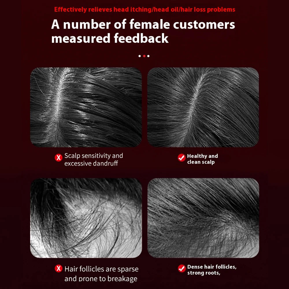 Peigne de massage ½Ç vibration ¹Èlectrique, lumiõ¹re Purple, follicule des cheveux, cuir chevelu, huile, applicateur liquide, masseur de tÄÇte, croissance des cheveux, anti-perte